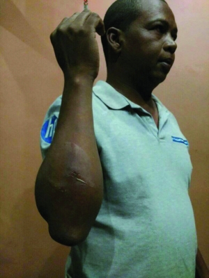 Palais des sports à Mahamasina - Quand des policiers agressent des journalistes