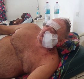 Agression sanglante sur fond de cambriolage - Un hôtelier français violemment pris pour cible à Nosy Be