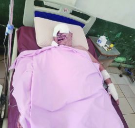 Attaque sanglante à Nosy Be - Un résident Français et son gardien dans un état critique