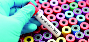 Maladie infectieuse - Hausse inquiétante des cas de toxoplasmose