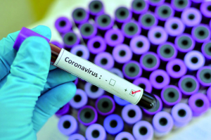 Epidémie - Un décès du coronavirus durant la semaine du 9 au 15 avril