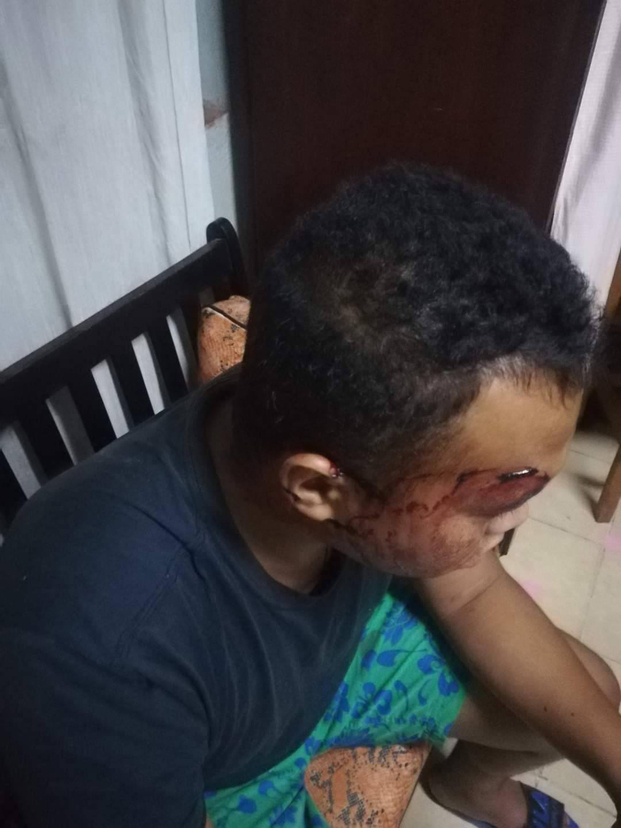 Banditisme à Ampamantanana Androndra - Six hommes armés sèment la terreur, un blessé grave