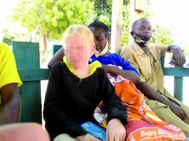 Victimes d’enlèvement et de persécution - Les enfants albinos en danger !