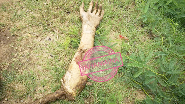 Atrocit&eacute;s &agrave; Mahajanga -&nbsp;Le corps d&eacute;membr&eacute; et mutil&eacute; d&rsquo;un albinos retrouv&eacute; dans les mangroves