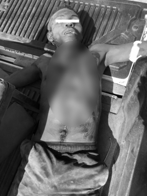 Assaut armé à Toliara - Un assaillant tombe sous les balles des Forces de défense