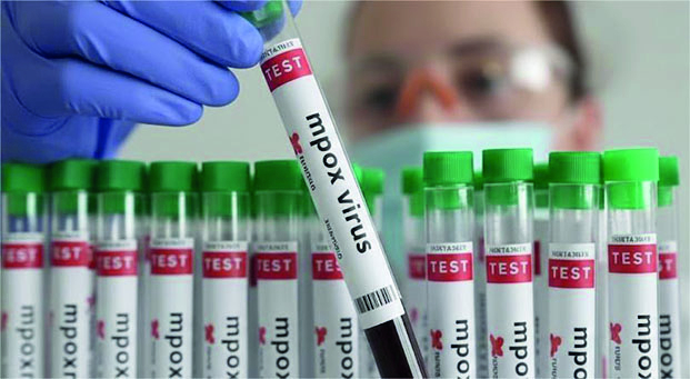 Mpox -&nbsp;Madagascar sous surveillance sanitaire de ses &icirc;les voisines