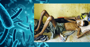 Santé - 50.000 tuberculeux à Madagascar